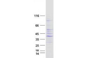 Western Blotting (WB) image for Proteasome (Prosome, Macropain) 26S Subunit, Non-ATPase, 14 (PSMD14) protein (Myc-DYKDDDDK Tag) (ABIN2729978)