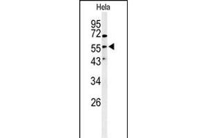 Western blot analysis of Vimentin-S82 (ABIN389211 and ABIN2839366) in Hela cell line lysates (35 μg/lane).