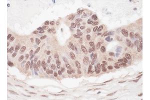 anti-Lethal(3) Malignant Brain Tumor-Like Protein 2 (L3MBTL2) (AA 655-705) antibody