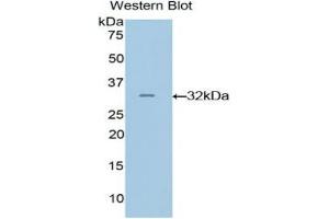 Western blot analysis of the recombinant protein. (GRAP2 抗体  (AA 20-262))