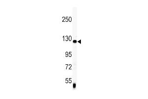 Western blot analysis of anti-Vinculin Antibody (C-term) (ABIN391626 and ABIN2841546) in mouse lung tissue lysates (35 μg/lane). (Vinculin 抗体  (C-Term))