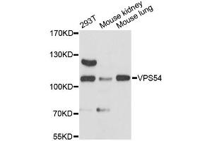 Western blot analysis of extracts of various cell lines, using VPS54 antibody (ABIN6293850) at 1:3000 dilution. (VPS54 抗体)