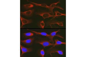 Immunofluorescence (IF) image for anti-WNK Lysine Deficient Protein Kinase 3 (WNK3) (AA 500-600) antibody (ABIN7271382)