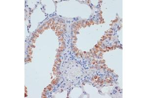 Immunohistochemistry of paraffin-embedded rat liver using SLC39 antibody (ABIN1682781, ABIN3017803, ABIN3017805 and ABIN6220263) at dilution of 1:100 (40x lens). (SLC39A4 抗体  (AA 23-327))