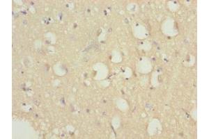 Immunohistochemistry of paraffin-embedded human brain tissue using ABIN7164431 at dilution of 1:100 (HERC6 抗体  (AA 764-1022))