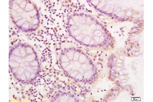 Immunohistochemistry (IHC) image for anti-Caudal Type Homeobox 2 (CDX2) (AA 151-250) antibody (ABIN732173)