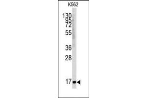 Image no. 1 for anti-Microsomal Glutathione S-Transferase 1 (MGST1) (Center) antibody (ABIN357900) (MGST1 抗体  (Center))