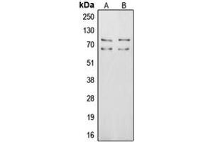 Western blot analysis of Vitronectin expression in MCF7 (A), HepG2 (B) whole cell lysates. (Vitronectin 抗体  (Center))