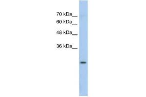 GSTM1 antibody used at 1 ug/ml to detect target protein. (GSTM1 抗体  (N-Term))