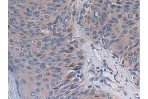 Immunohistochemistry (IHC) image for anti-Proprotein Convertase Subtilisin/kexin Type 5 (PCSK5) (AA 115-454) antibody (ABIN7435742)