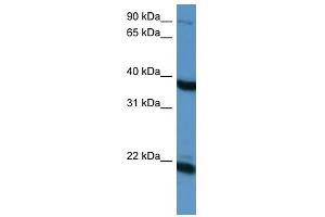 Pleiotrophin antibody used at 1 ug/ml to detect target protein. (Pleiotrophin 抗体)