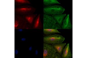 ABIN6259273 and ABIN6273655 staining  cells by IF/ICC. (FIL1h 抗体  (C-Term))
