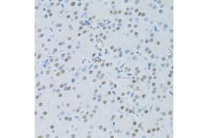 Immunohistochemistry of paraffin-embedded rat pancreas using SNRNP70 antibody. (SNRNP70 抗体  (AA 150-250))