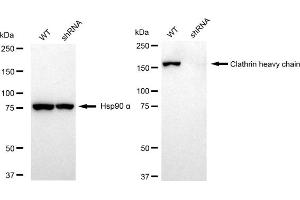 Western blotting analysis using Clathrin heavy chain antibody (ABIN7798090). (Recombinant Clathrin Heavy Chain (CLTC) 抗体)