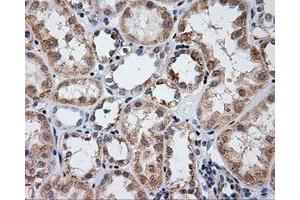 Immunohistochemical staining of paraffin-embedded liver tissue using anti-LIPG mouse monoclonal antibody. (LIPG 抗体)