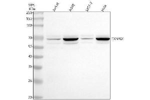 Western blot analysis of TXNRD1 using anti-TXNRD1 antibody (ABIN7602673).