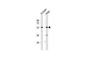 All lanes : Anti-TFG Antibody (Center) at 1:1000 dilution Lane 1: human brain lysate Lane 2: Hela whole cell lysate Lysates/proteins at 20 μg per lane. (TFG 抗体  (AA 85-114))