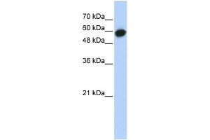 WB Suggested Anti-LRRC6 Antibody Titration: 0.
