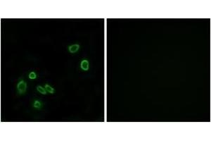 Immunofluorescence analysis of A549 cells, using BRP44L Antibody. (BRP44L 抗体  (AA 11-60))
