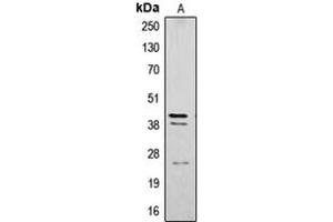 Western blot analysis of Cathepsin B expression in SW480 (A) whole cell lysates. (Cathepsin B 抗体  (Center))