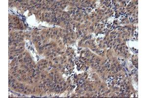 Image no. 2 for anti-Tripartite Motif Containing 38 (TRIM38) (AA 1-265) antibody (ABIN1490680) (TRIM38 抗体  (AA 1-265))
