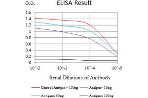Black line: Control Antigen (100 ng),Purple line: Antigen (10 ng), Blue line: Antigen (50 ng), Red line:Antigen (100 ng) (LY75/DEC-205 抗体  (AA 1520-1666))