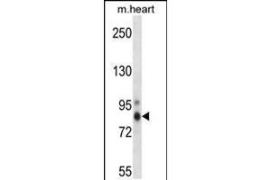 Western blot analysis in mouse heart tissue lysates (35ug/lane). (PKC eta 抗体  (AA 314-341))