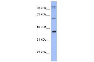 KCTD4 antibody used at 1 ug/ml to detect target protein. (KCTD4 抗体  (N-Term))