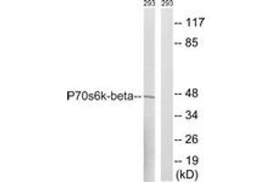 Western blot analysis of extracts from 293 cells, using p70 S6 Kinase beta (Ab-423) Antibody. (RPS6KB2 抗体  (AA 389-438))