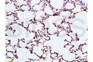 Formalin-fixed and paraffin embedded rat lung labeled with Anti-SP-D PSPD Polyclonal Antibody, unconjugated (ABIN731678) at 1:200, followed by incubation with conjugated secondary antibody and DAB staining. (SFTPD 抗体  (AA 301-375))