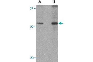 Western blot analysis of DNAL1 in NIH/3T3 cell lysate with DNAL1 polyclonal antibody  at (A) 1 and (B) 2 ug/mL . (DNAL1 抗体  (C-Term))