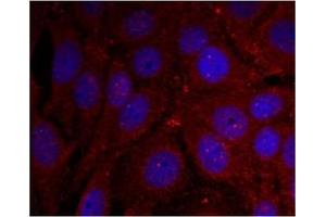 Image no. 2 for anti-Synuclein, alpha (SNCA) (pTyr136) antibody (ABIN401576) (SNCA 抗体  (pTyr136))