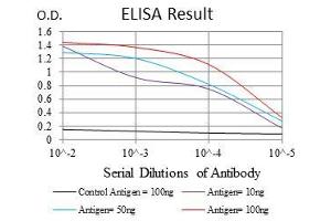 Black line: Control Antigen (100 ng), Purple line: Antigen(10 ng), Blue line: Antigen (50 ng), Red line: Antigen (100 ng), (PPP1CA 抗体)
