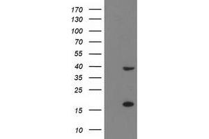 Western Blotting (WB) image for anti-PDZ and LIM Domain 2 (PDLIM2) antibody (ABIN1500125) (PDLIM2 抗体)