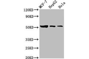 Western Blot Positive WB detected in: MCF-7 whole cell lysate, HepG2 whole cell lysate, Hela whole cell lysate All lanes: GBA antibody at 3. (GBA 抗体  (AA 215-343))