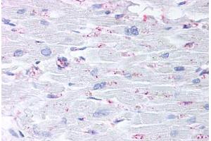 Anti-CYSLTR2 / CYSLT2 antibody  ABIN1048490 IHC staining of human heart. (CasLTR2 抗体  (C-Term))