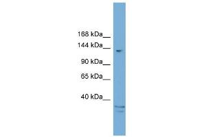 WB Suggested Anti-ARID5B Antibody Titration:  0. (ARID5B 抗体  (C-Term))