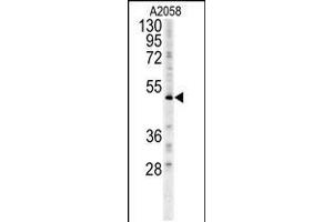 Western blot analysis in A2058 cell line lysates (15ug/lane). (FOXC2 抗体  (AA 159-186))