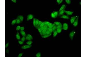 Immunofluorescence staining of HepG2 cells with ABIN7153203 at 1:166, counter-stained with DAPI. (FBP2 抗体  (AA 283-339))