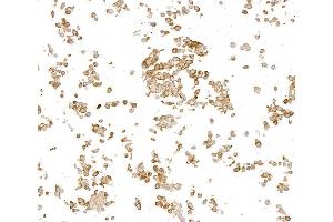Immunocytochemistry (ICC) image for anti-Metadherin (MTDH) (AA 475-525) antibody (ABIN7795651) (Recombinant MTDH 抗体  (AA 475-525))