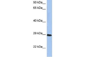 WB Suggested Anti-CRYBA1 Antibody Titration: 0. (CRYBA1 抗体  (N-Term))