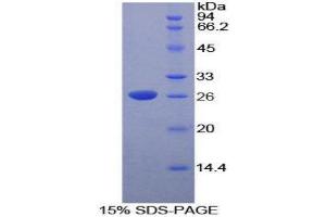 SDS-PAGE (SDS) image for Deoxyribonuclease I-Like 2 (DNASE1L2) (AA 32-229) protein (His tag) (ABIN1878854)