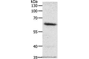 Western blot analysis of Mouse heart tissue, using FZD4 Polyclonal Antibody at dilution of 1:200 (FZD4 抗体)
