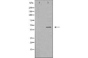 Western blot analysis of U937 cell lysate, using FCGR1A Antibody. (FCGR1A 抗体  (Internal Region))