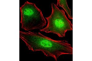 Fluorescent image of Hela cells stained with FUBP3 Antibody (N-term) B. (FUBP3 抗体)