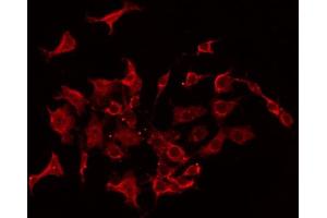 ABIN6267406 staining Hela by IF/ICC. (Stathmin 1 抗体  (pSer38))