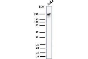 Western Blot Analysis of human HeLa cell lysate using Spectrin beta III Mouse Monoclonal Antibody (SPTBN2/1582). (Spectrin, Beta, Non-erythrocytic 2 (SPTBN2) (AA 356-475) 抗体)