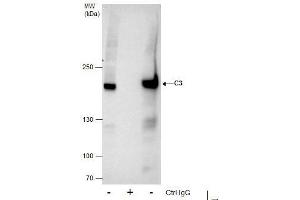 IP Image Immunoprecipitation of C3 protein from HepG2 whole cell extracts using 5 μg of C3 antibody [C3], C-term, Western blot analysis was performed using C3 antibody [C3], C-term, EasyBlot anti-Rabbit IgG  was used as a secondary reagent. (C3 抗体  (C-Term))