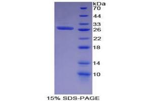 SDS-PAGE analysis of Mouse EGFR2 Protein. (EGFR2 蛋白)