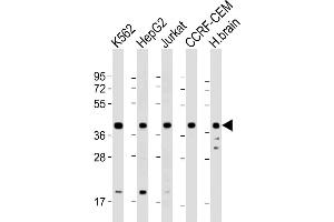 Western Blot at 1:2000 dilution Lane 1: K562 whole cell lysate Lane 2: HepG2 whole cell lysate Lane 3: Jurkat whole cell lysate Lane 4: CCRF-CEM whole cell lysate Lane 5: human brain lysate Lysates/proteins at 20 ug per lane.